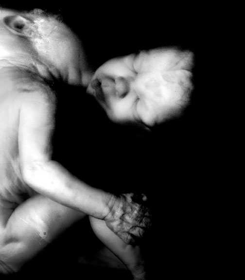 Conjoined Twins, photography by Brandon Zimmerman. In People, Portrait
