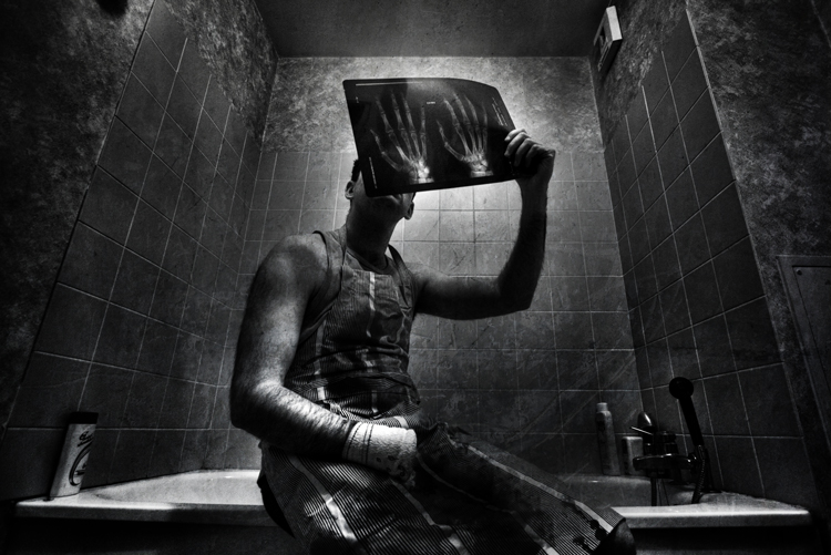 Home-made surgery, processing by Matthieu G.. Selfsex is over, now ;). In People, Character